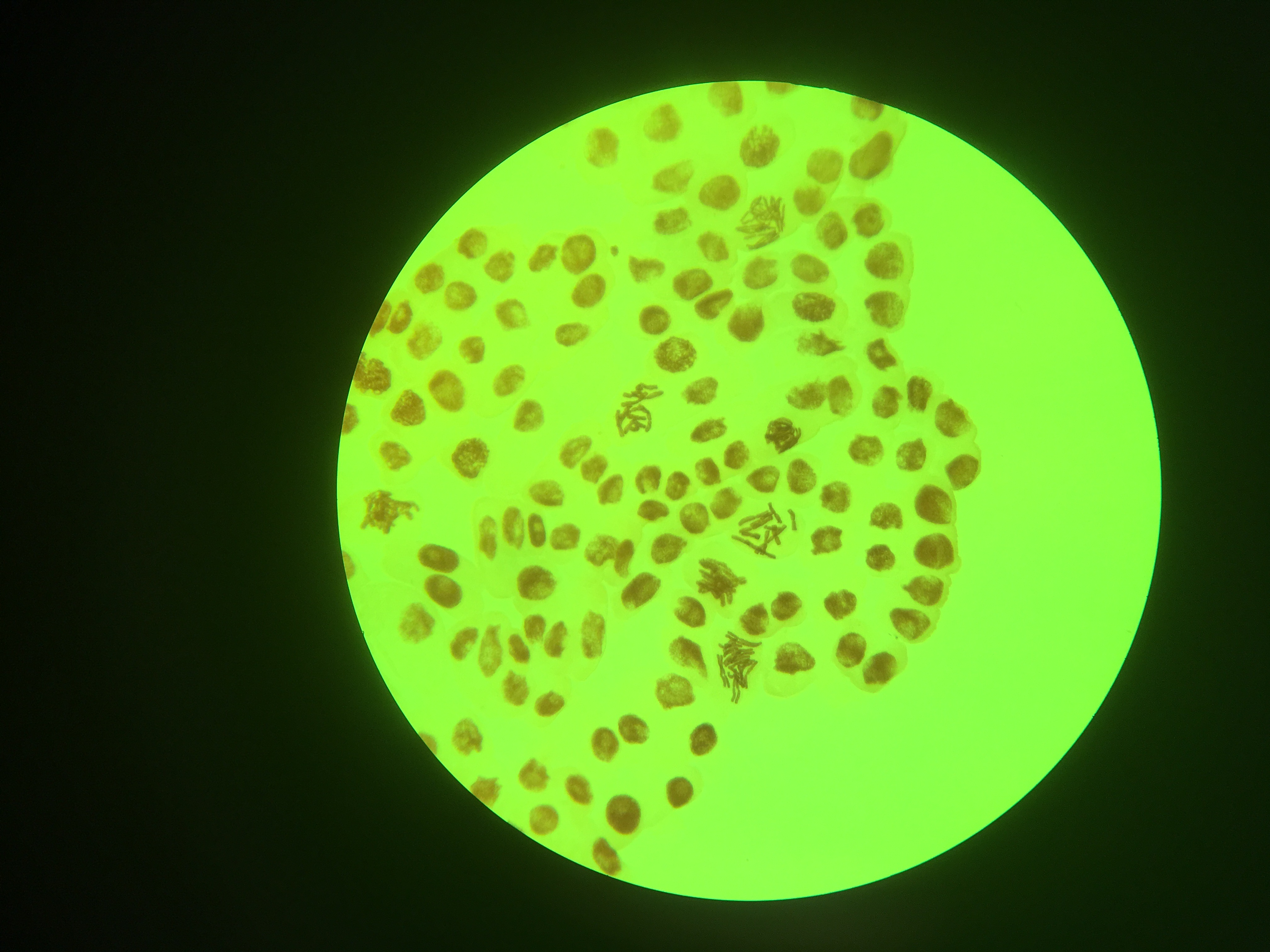 Tulbaghia chromosomes